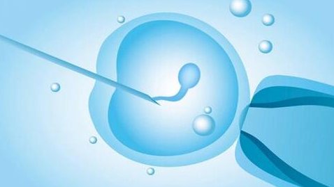 美国私人助孕去哪做子宫早衰试管婴儿？